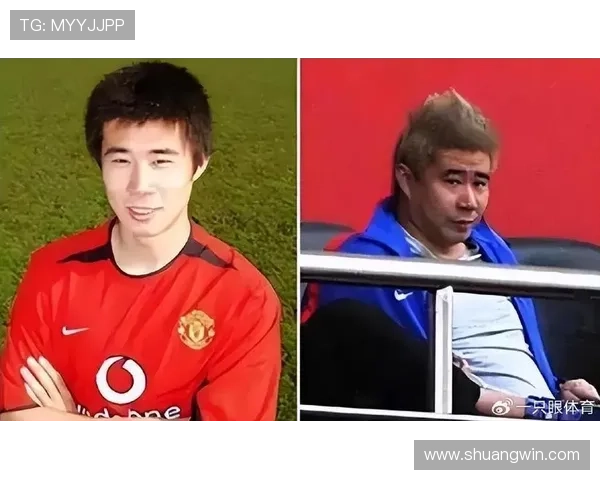 董方卓回忆奥运封闭训练时的伤病经历与曼联队医的手术建议